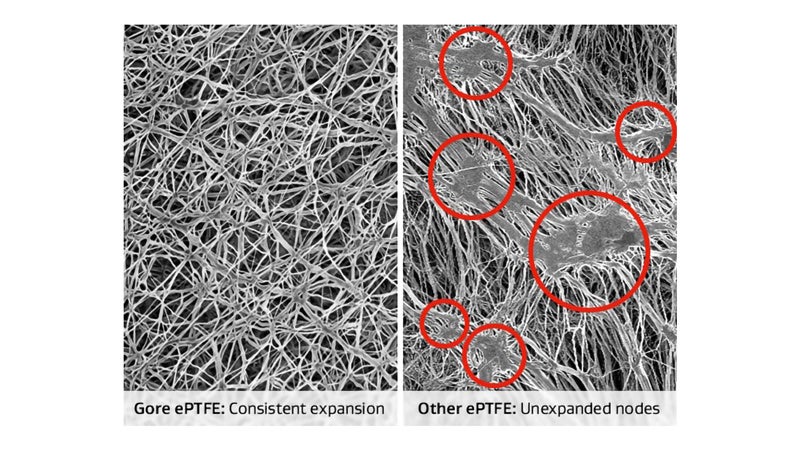 Gore ePTFE vs Other ePTFE