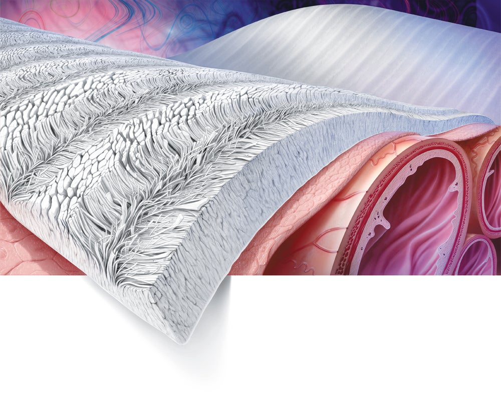 goretex tissue reinforcement