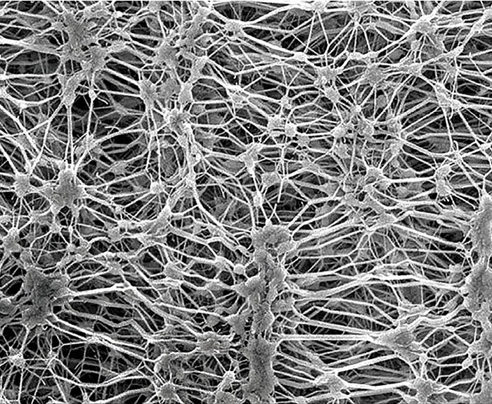 Eptfe membrane